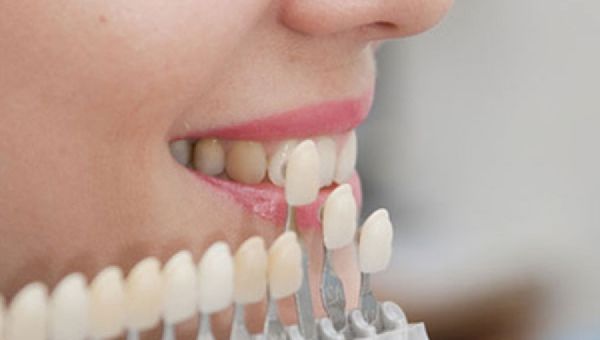 Fix Your Smile In No Time With Porcelain Veneers