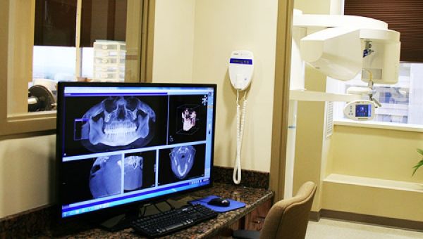 CT-Guided Dental Implants: Advanced Technology for Better Results